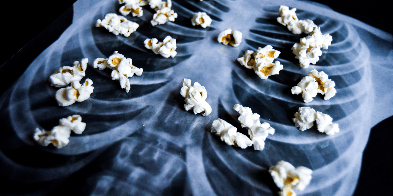 Bild på x-ray med popcorn